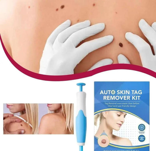 MySkiné™ ¡No más marcas en la piel! ✨